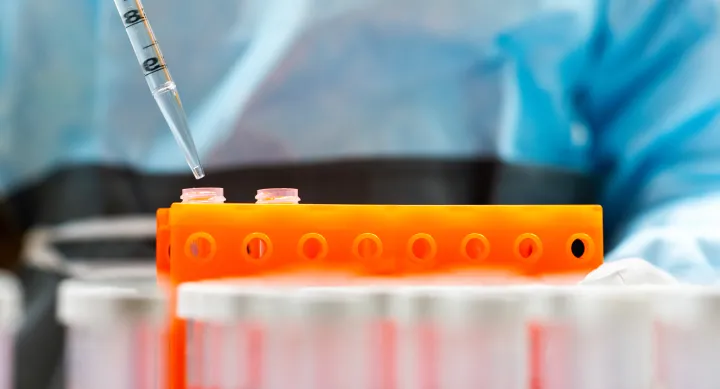 Scientist useing an eye dropper to put liquid into test tubes